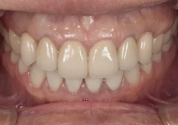 治療後写真 | 噛み合わせ治療・矯正歯科専門 荒谷デンタルクリニック