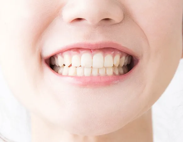 噛み合わせの写真 | 噛み合わせ治療・矯正歯科専門 荒谷デンタルクリニック