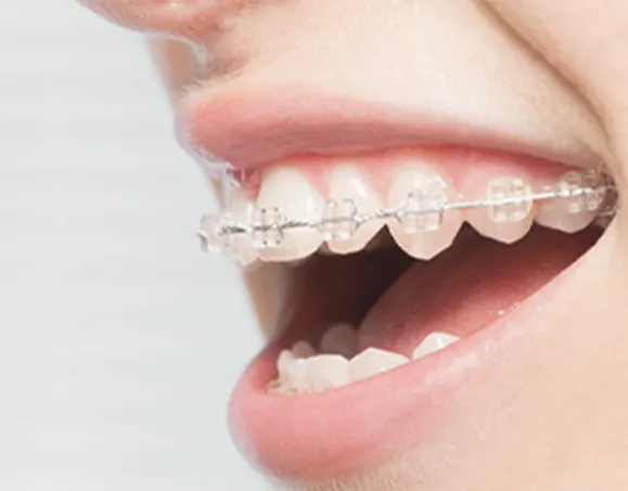 矯正歯科の写真 | 噛み合わせ治療・矯正歯科専門 荒谷デンタルクリニック